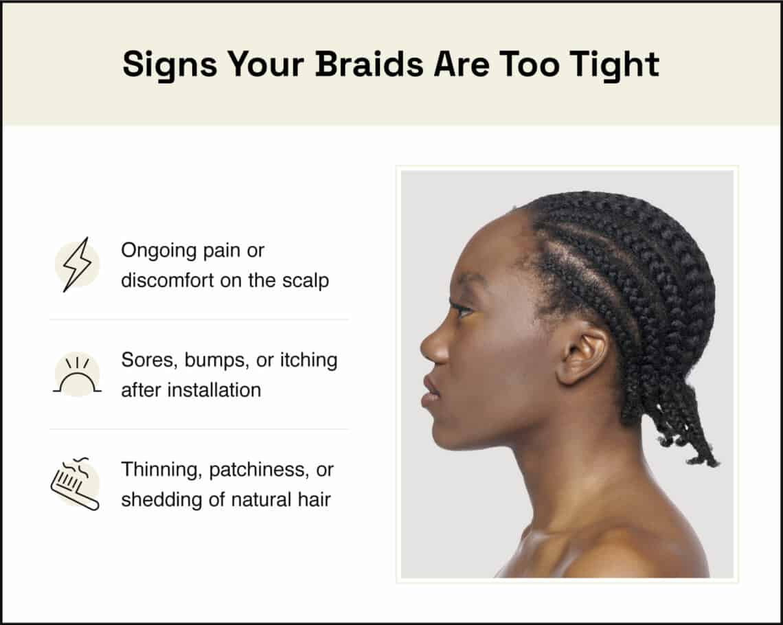 Signs Your Braids Are Too Tight 1140x910 