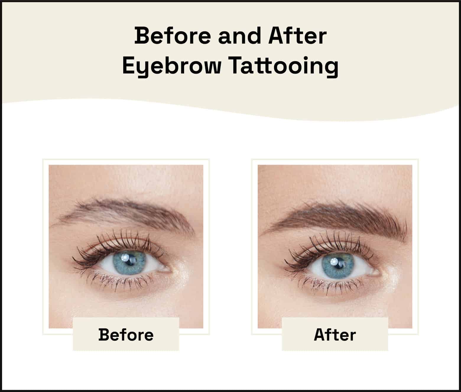 Two close up photos of a woman’s eyebrow show the before and after results of eyebrow tattooing. 