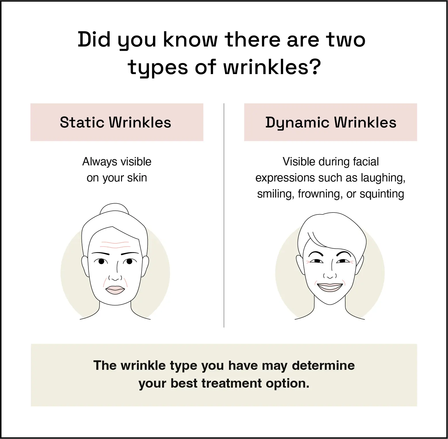 Difference between static wrinkles and dynamic wrinkles. 