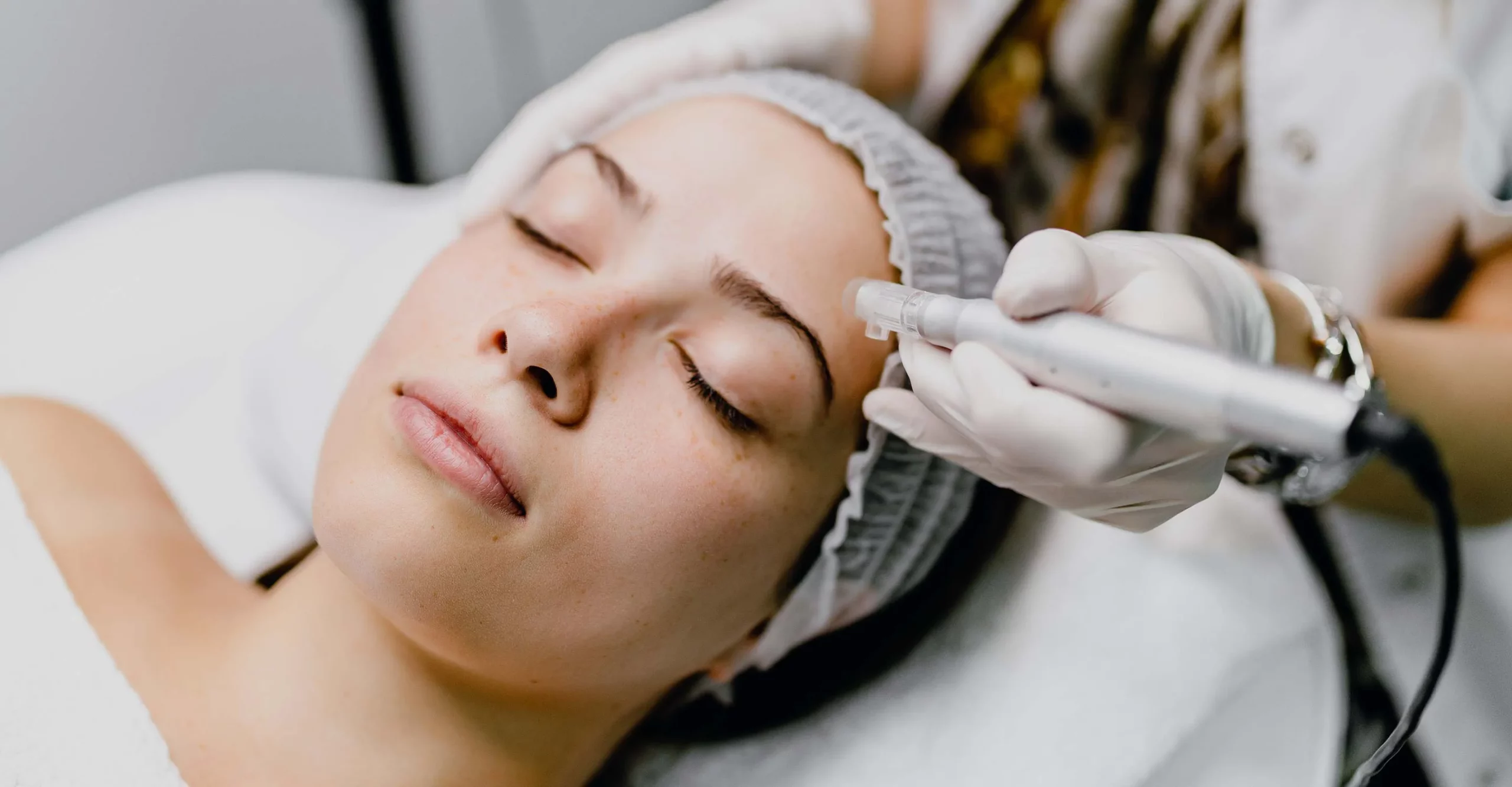 Image shows woman having microneedling treatment performend on face.