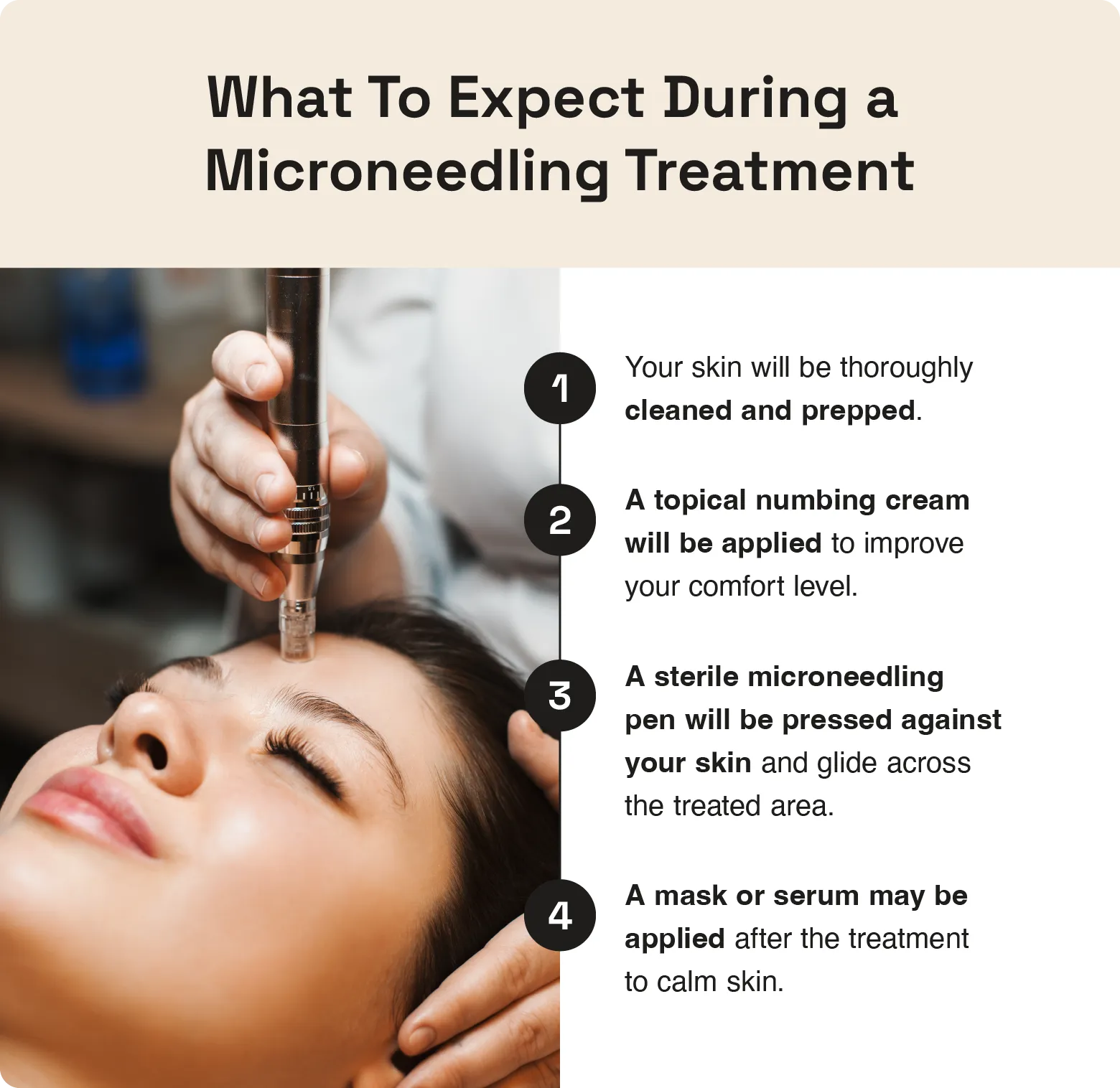 Image shows what to expect during a microneedling appointment. 