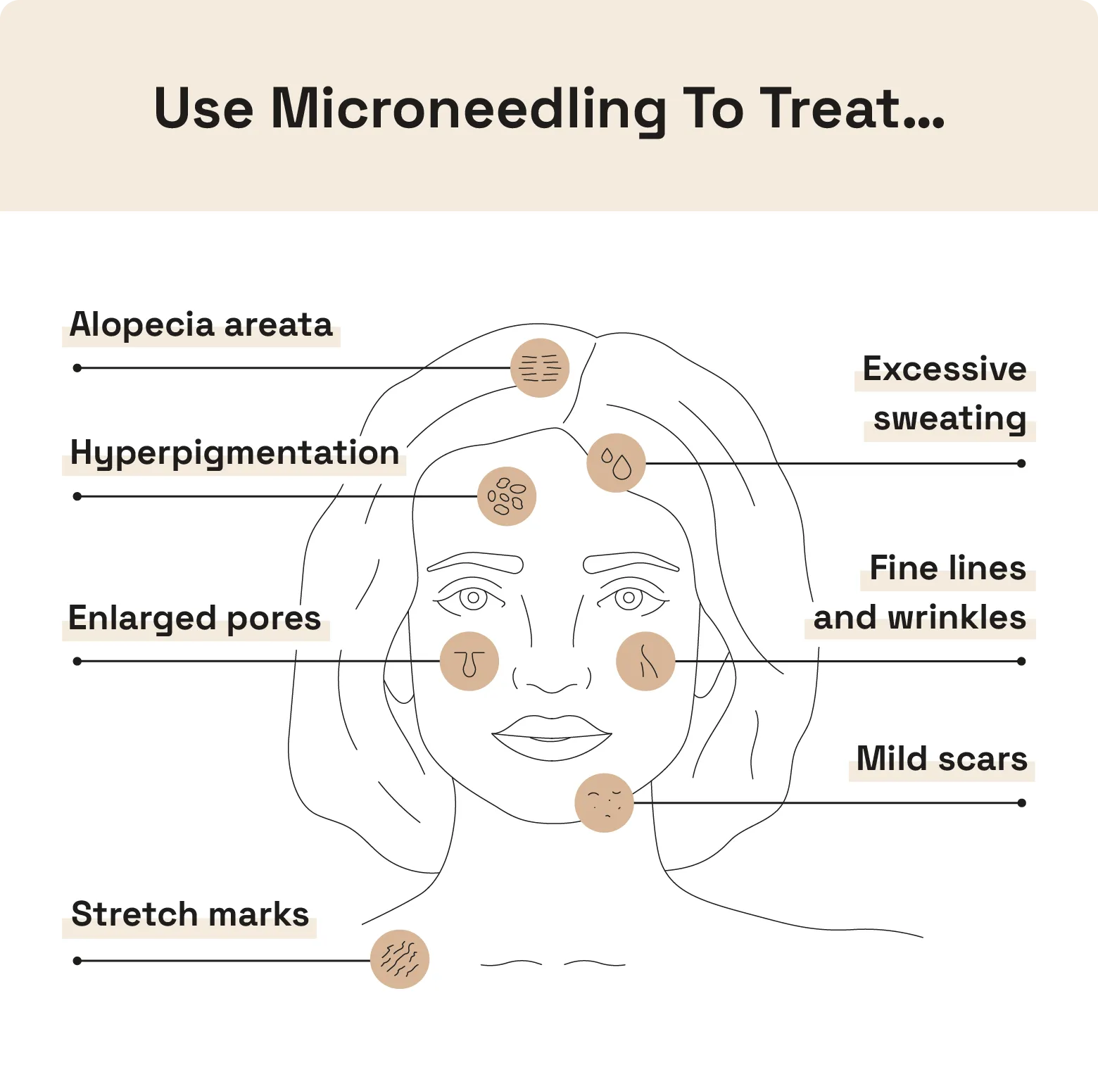 Image shows the skin concerns microneedling treats. 