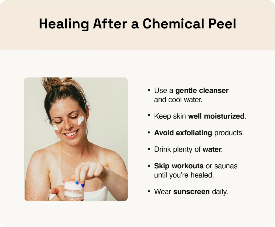 Image covers healing tips for after a chemical peel.